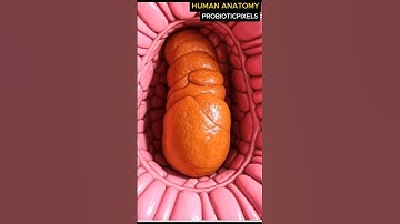 DRAMATIC 3D BLOCKED COLON: PERISTALSIS IN ACTION