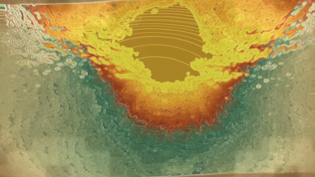 《♫Vision Loss♫》