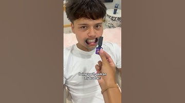 Tooth gems 💎 #viralvideo