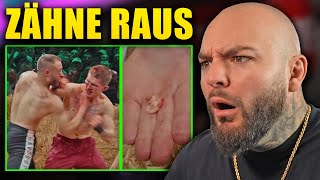 Zähne raus GEPRÜGELT! Kranker Kampf bei TopDog! RINGLIFE