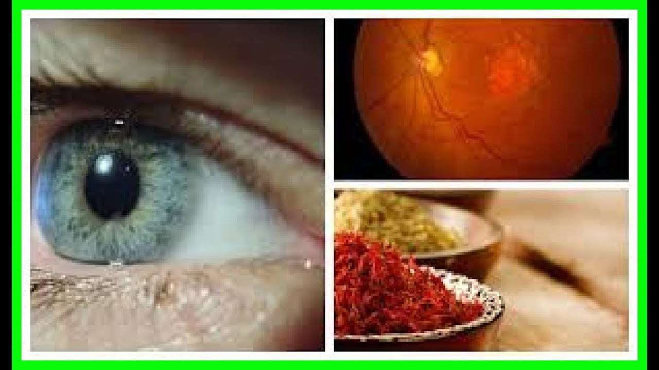 AGREGA ESTO A TU CAFÉ, Y DEJARAS DE USAR LENTES PORQUE TU