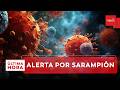 Alerta de salud: Sarampión y crisis hospitalaria en Colombia | Última Hora Caracol