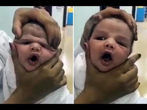 Newborn baby gets head deliberately squashed by giggling nurses in horrifying video