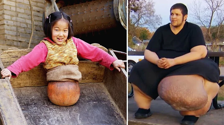 15 Humans You Won’t Believe Actually Exist