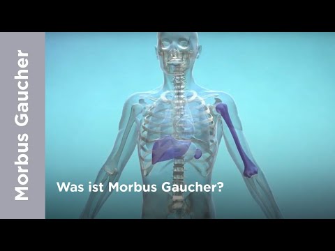 Video: Wer kann die Gaucher-Krankheit bekommen?