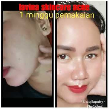 Asli lavina skincare MANTUL