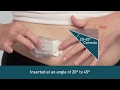 Tandem Diabetes Care - Introduction To Infusion Sets