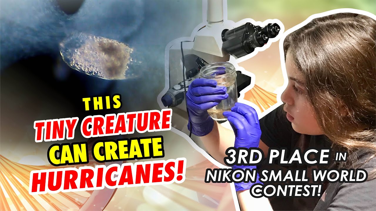 Stylonychia Vortex 3rd place in Nikon small world contest!