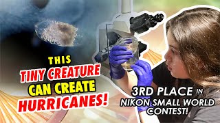 Stylonychia Vortex 3Rd Place In Nikon Small World Contest