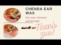 Mr chenda cleaning ear wax from chinese ear cleaning foreigner9