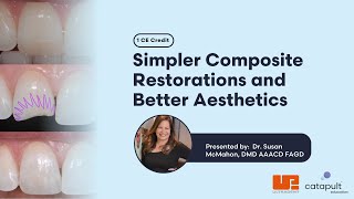 Dental Treatment: Simpler Composites | Apr 2, 2024