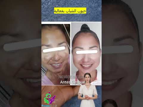 كريم كرتون الحل السحري لتفتيح البشره تفتيح البشره جمال البشرة