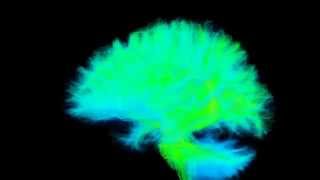 White matter tractography - wiring of the brain
