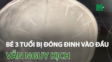 Bé 3 tuổi bị đóng đinh vào đầu vẫn nguy kịch, có thể được truyền máu từ bố | VTC14