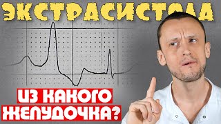 Из какого желудочка ЭКСТРАСИСТОЛА ? Желудочковая экстрасистолия