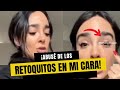 Manelyk González CASI PIERDE EL OJO por cirugía estética.