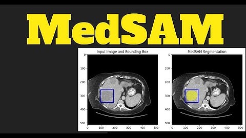 MedSAM Segment Anything in Medical Images Universal medical image segmentation.