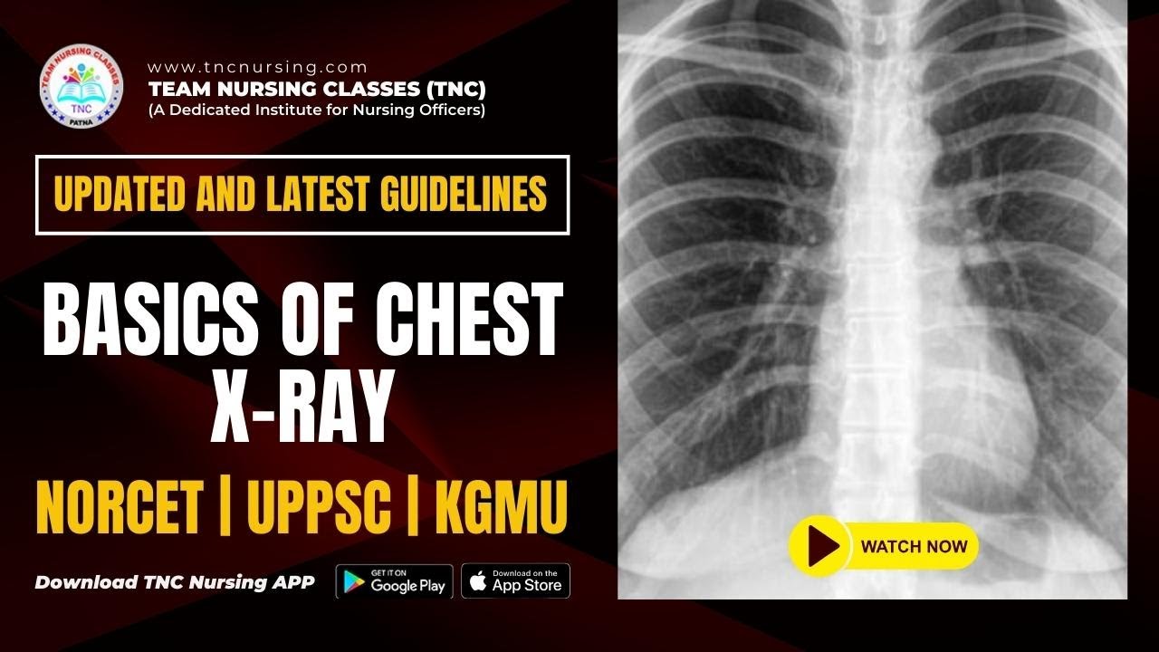 MCQ Of the DAY #28 || BASICS OF CHEST X RAY  || TNC NURSING || 