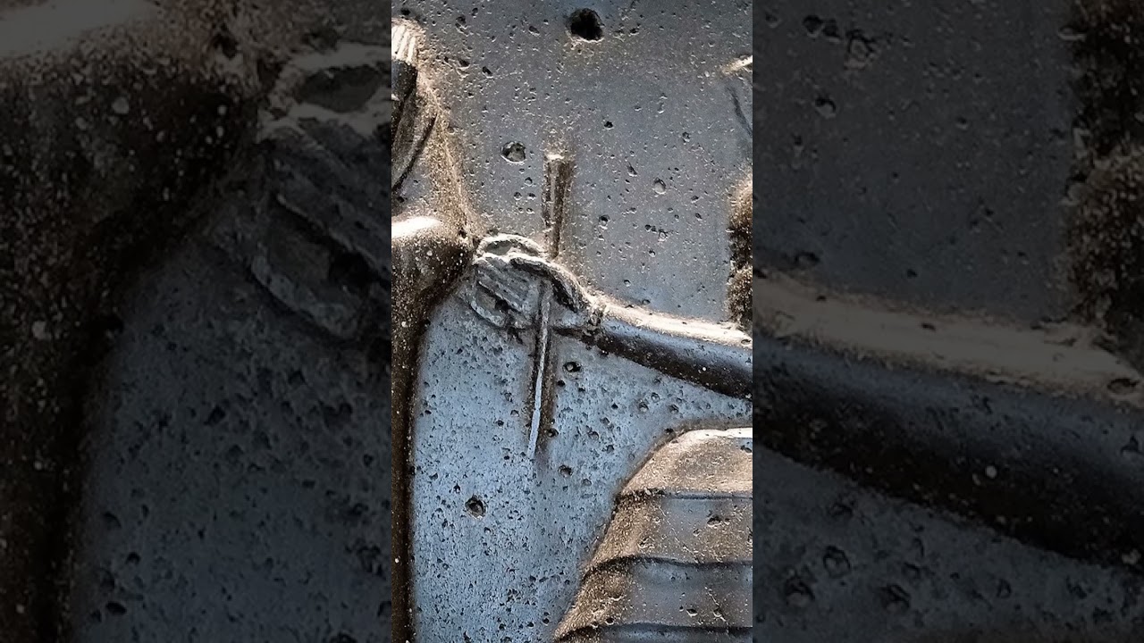 Ancient Babylon Doctor Fails Resulting in Amputation! 