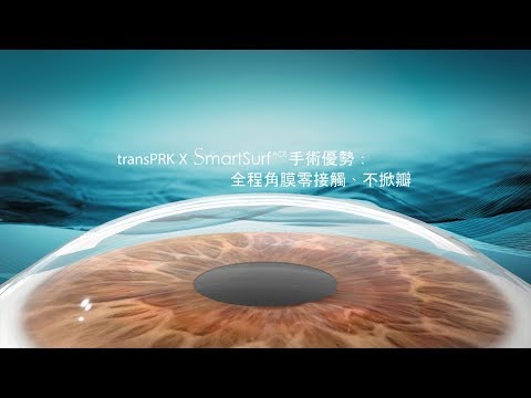 transPRK x SmartSurfACE 安全不掀瓣近視雷射手術