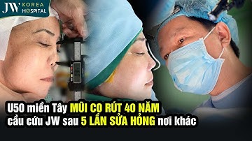 Bác Sĩ Tú Dung CHỮA TRỊ MŨI CO RÚT, BIẾN DẠNG 40 NĂM Cho U50 Miền Tây