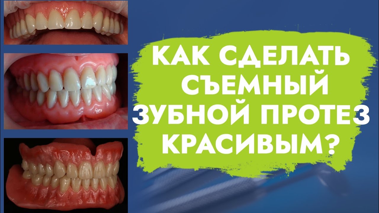 Как сделать съемный зубной протез красивым? - YouTube