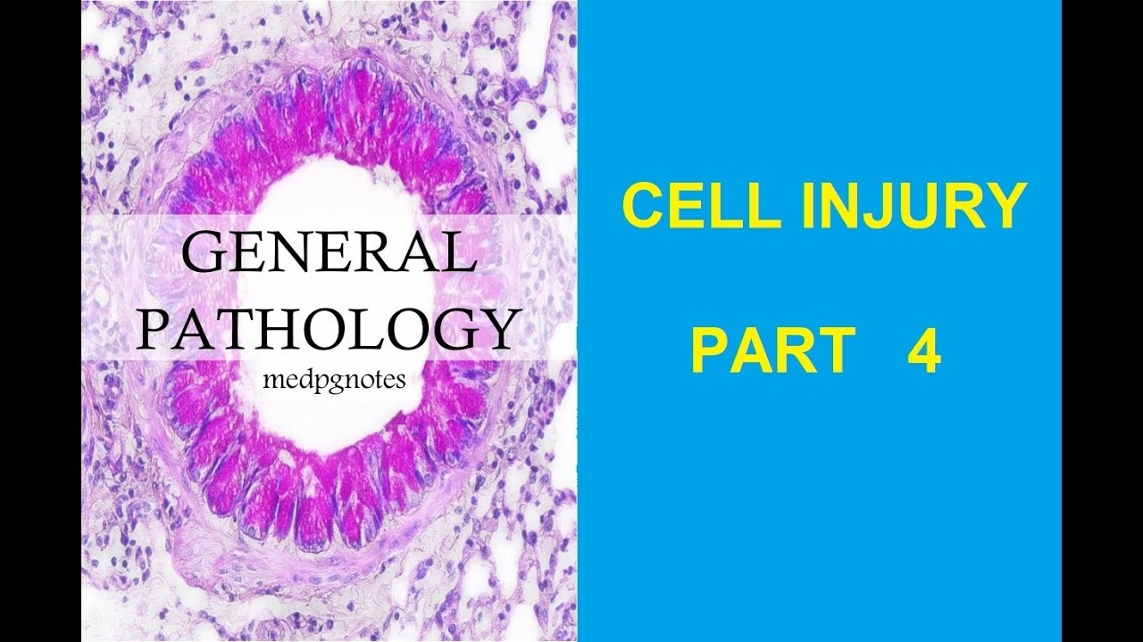 GENERAL PATHOLOGY II CHAPTER 2 II CELL INJURY II PART 4 II ROBBINS 10TH EDITION