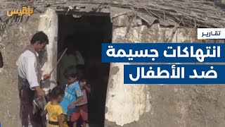 تقرير حقوقي يكشف مسؤولية مليشيا الحوثي عن غالبية الانتهاكات بحق الأطفال | تقرير: موسى النمراني