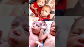 Cute Twin Newborn Babies First Cry Amazing Funny Moments