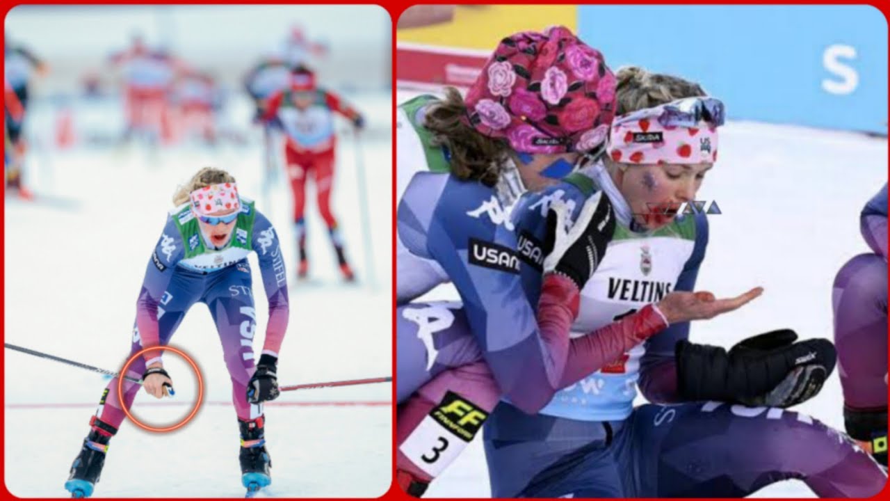 Jessie Diggins Ruka Jessie Diggins, bloódíed and missing a glove