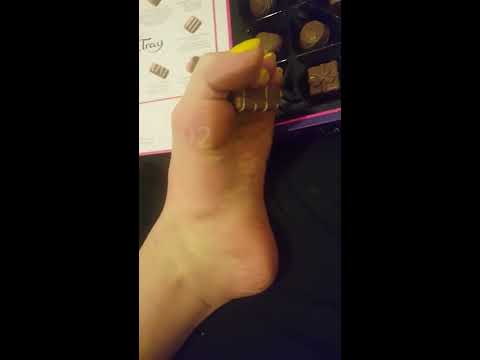 Sweet feet