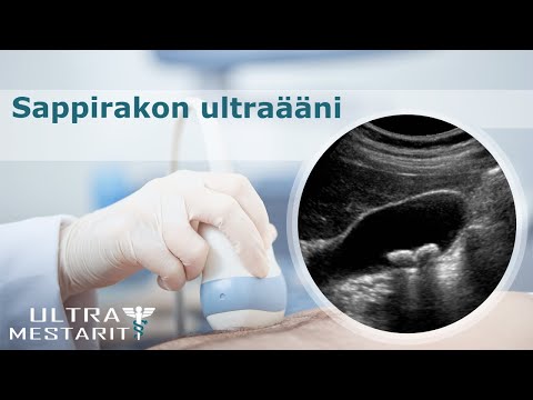 Video: Torakoiden Ultraääni: Ansoja, Toimintaperiaate, Katsaus Tällaisten Laitteiden Käyttöön + Valokuvat Ja Videot