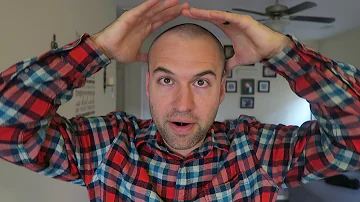 Are bald dudes attractive?