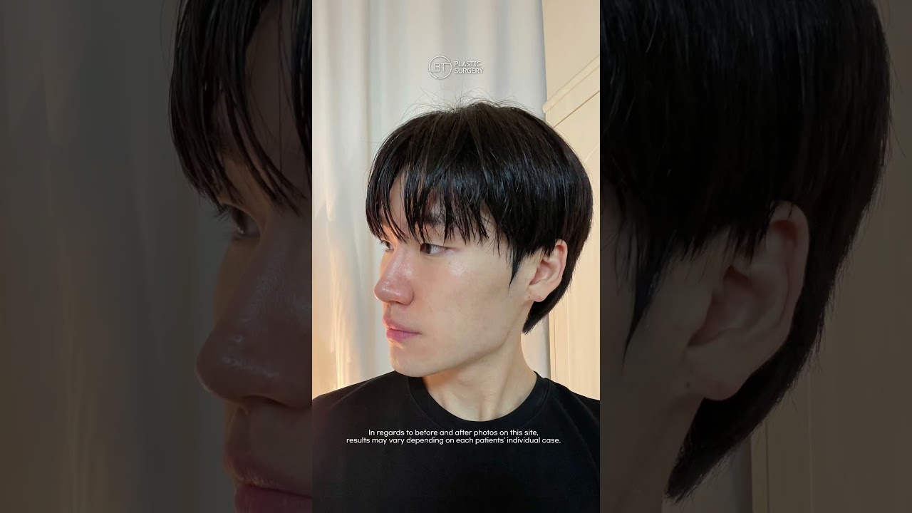 Facial Contouring with Doctor Lee Hobin, BT Plastic Surgery
