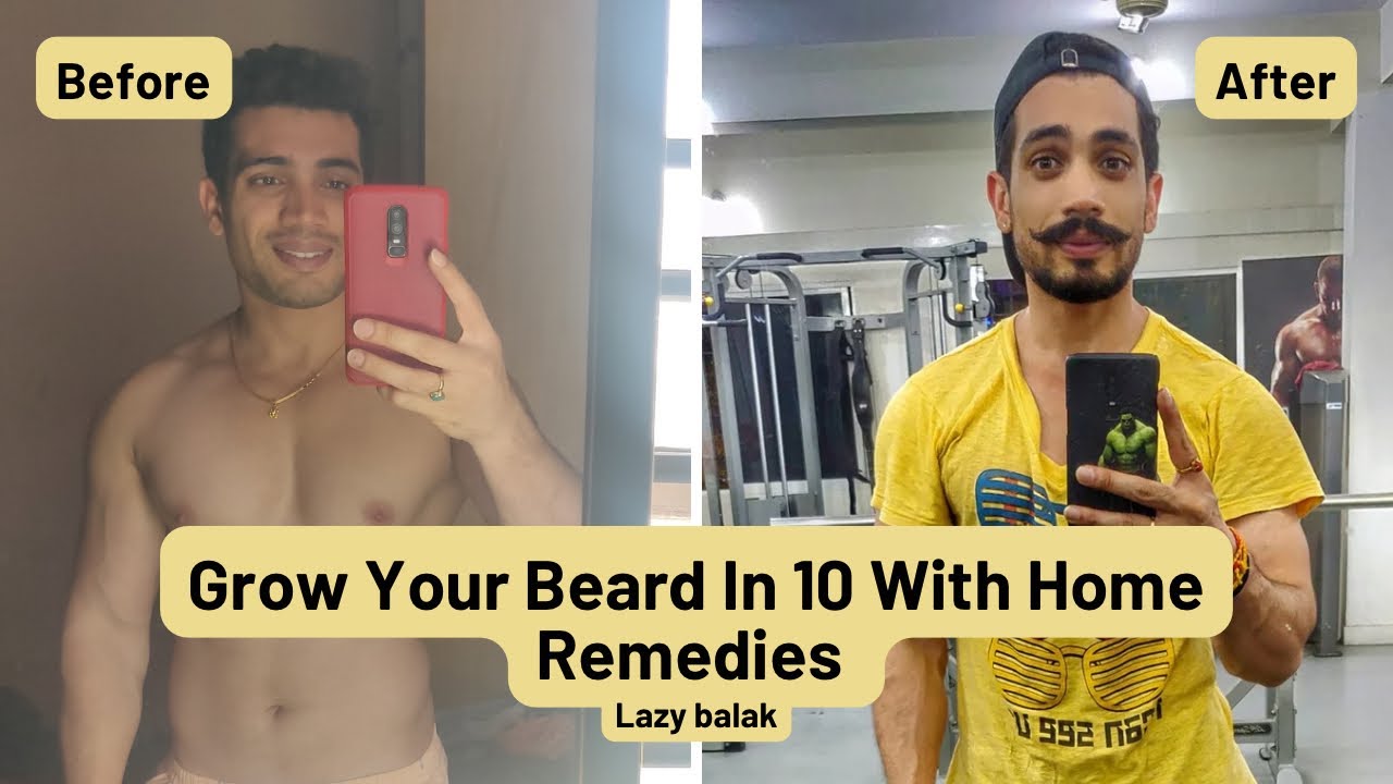 Guarantee Home Beard Growth Hack | Beard Growth Ke Desi Nukshe | Hindi 2023