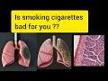 Is smoking cigarettes bad for you ?