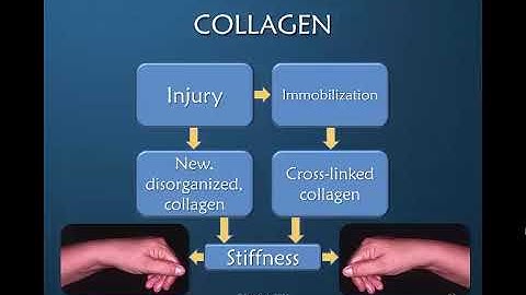 Nuances of Mobilizing the Stiff Hand: Part 3 of 9: Collagen