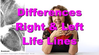 Differences between Right and Left Life Lines