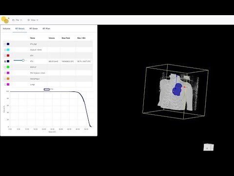 Dose Volume Histogram DVH, finally  on the Browser....