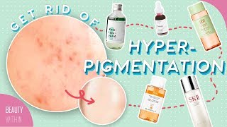 Best Ways to Reduce Hyperpigmentation & Dark Spots: Ingredients, Products & Natural Remedies