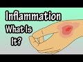 Inflammation - Inflammatory Response - What Is Inflammation In The Body?