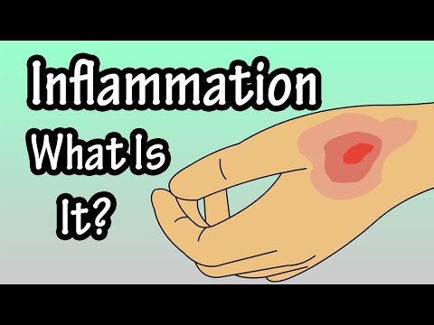 Video: Inflammation I Livmoderhalskanalen - Orsaker, Symtom, Diagnos