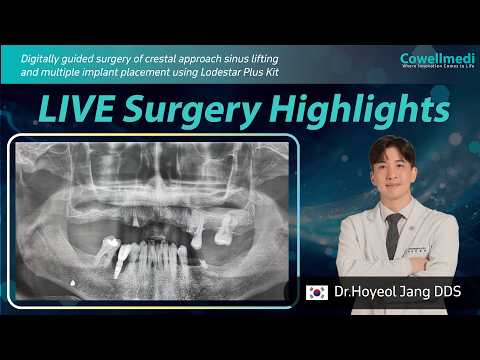 Live surgery Highlights (Dr. Hoyeol Jang)