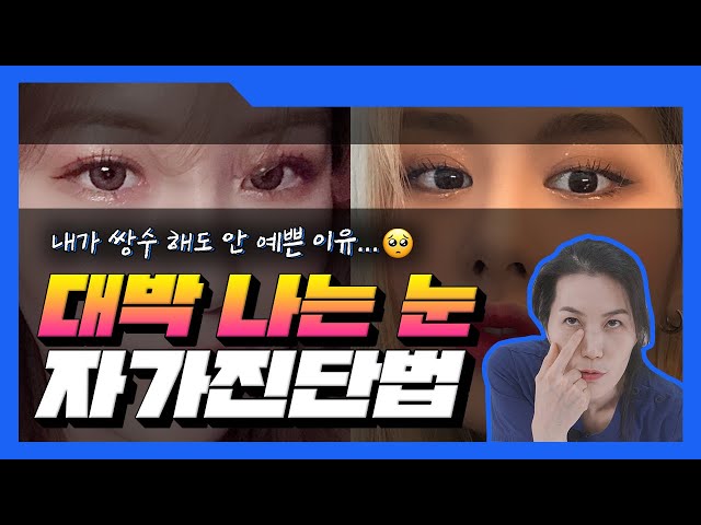 [눈성형] 대박 나는 눈은 따로 있다? (내가 쌍수 해도 안 예쁜 이유...😢)