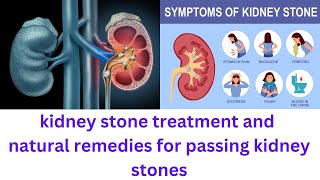 how to pass kidney stones