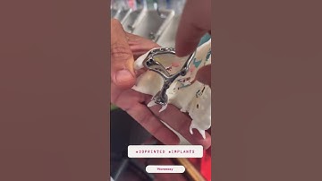 @BoneEasy factory with CEO Rui Coelho #3dprinted #craniofacialmaxillary #CMF #Reconstruction #plates