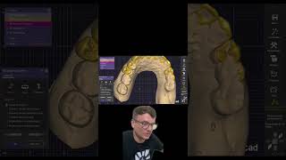 Dica Para Iniciante No Software Exocad cadcam dentist dentista exocad odontologia