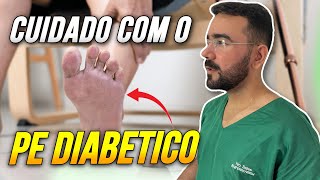 PREVENÇÃO DO PÉ DIABÉTICO EM PACIENTES COM DIABETES  - O QUE ORIENTAR?