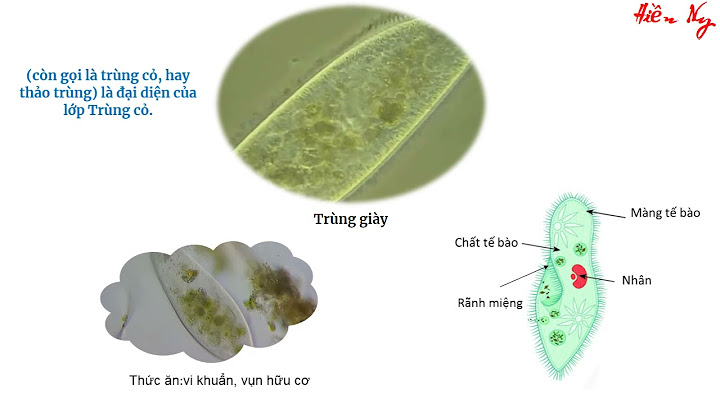 Trùng giày có hình dạng như thế nào