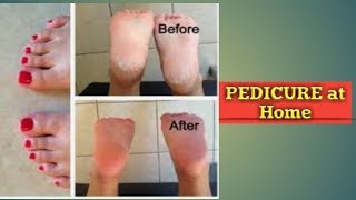 #homemade #pedicure #simplesteps SIMPLE PEDICURE at Home | Let your feet GLOW | KOTHAPUDI SNEHA